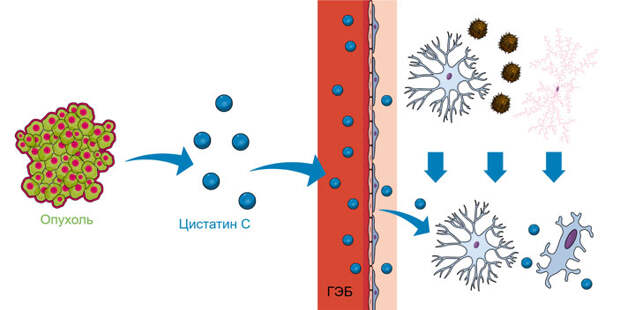 Рис. 3. Опухолевые клетки разных типов секретируют цистатин C, который выделяется в кровь, проникает через гематоэнцефалический барьер и способствует разрушению амилоидных бляшек