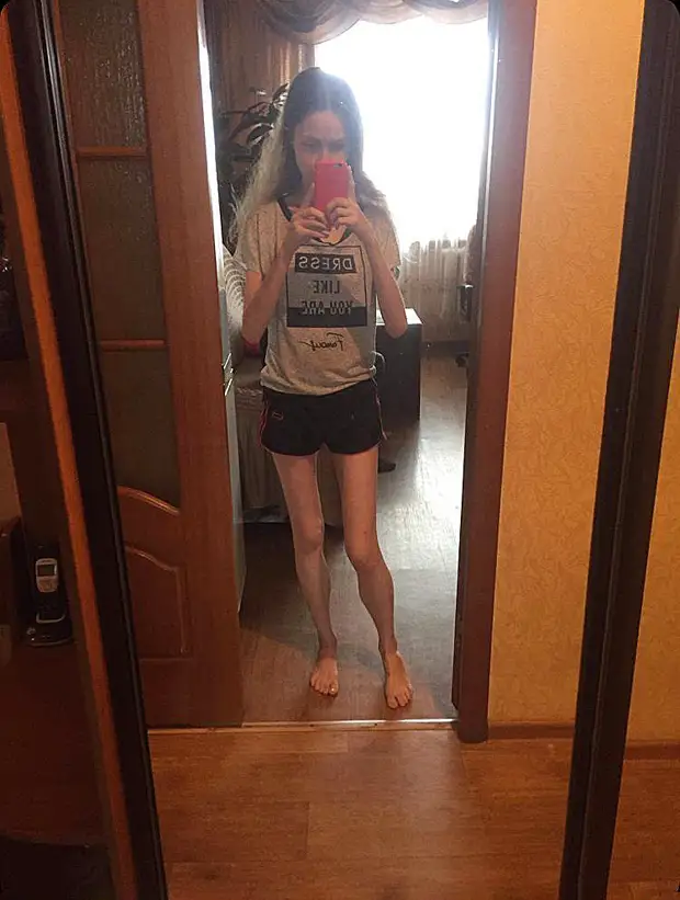 «Не могу спать и есть»: жительница Ульяновска больше года пытается восстановиться после коронавируса