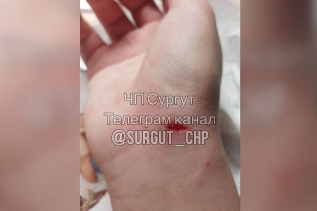 Ura.ru: в Сургуте на двух девушек и их собак напал алабай