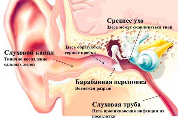 Лечение воспалительных заболеваний среднего уха. Краткое описание