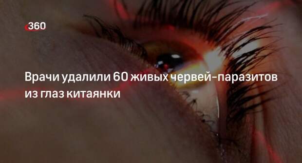 The Sun: врачи извлекли 60 живых червей-паразитов из глаз женщины в Китае