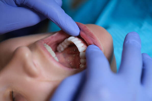 Больше половины россиян никогда не посещали врача-ортодонта