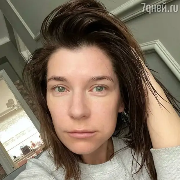 Перенесла операцию: Екатерина Волкова показала лицо с жутким отеком