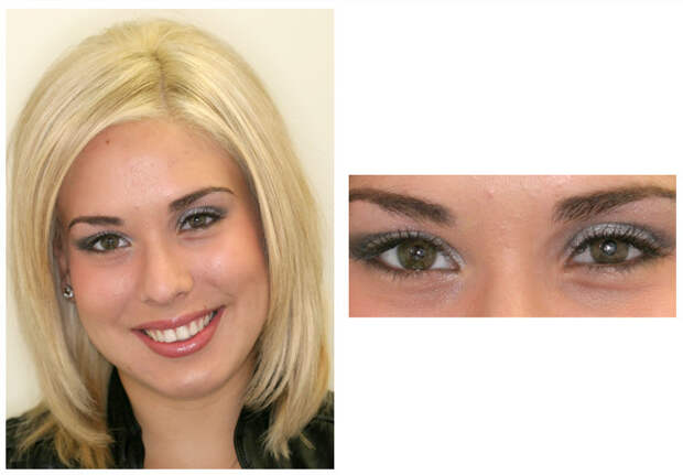 Операция по удалению глаза у человека