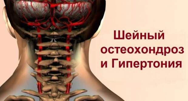 izbavsya_ot_xronicheskoj_boli__naget_ru