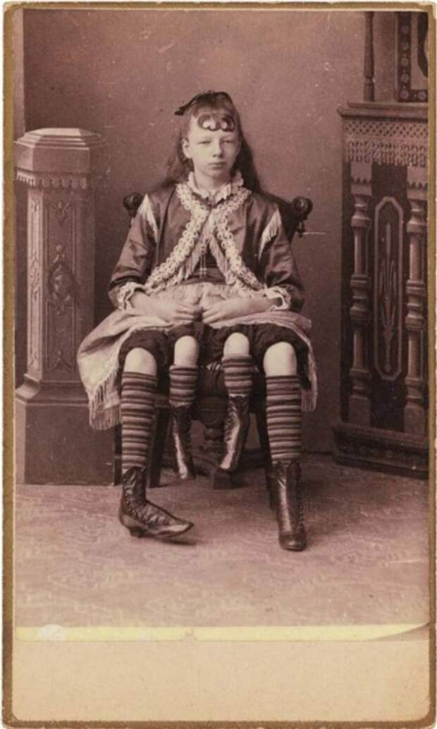 Популярные артисты старого цирка (20 фото)
