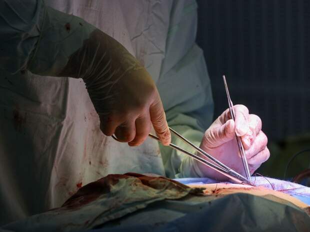 Ишимские врачи спасли мужчину, проглотившего зажигалку