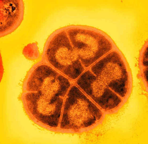 Deinococcus radiodurans