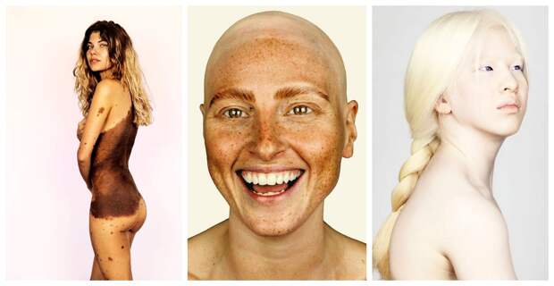 Нестандартная красота: 22 портрета фотографа Брока Элбанка