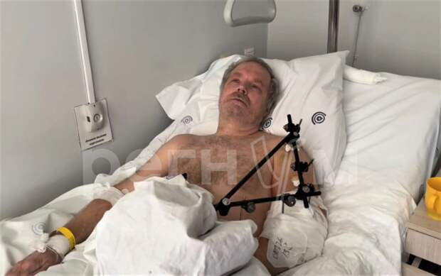 Белгородские хирурги спасли руку мужчине, пострадавшему при обстреле города