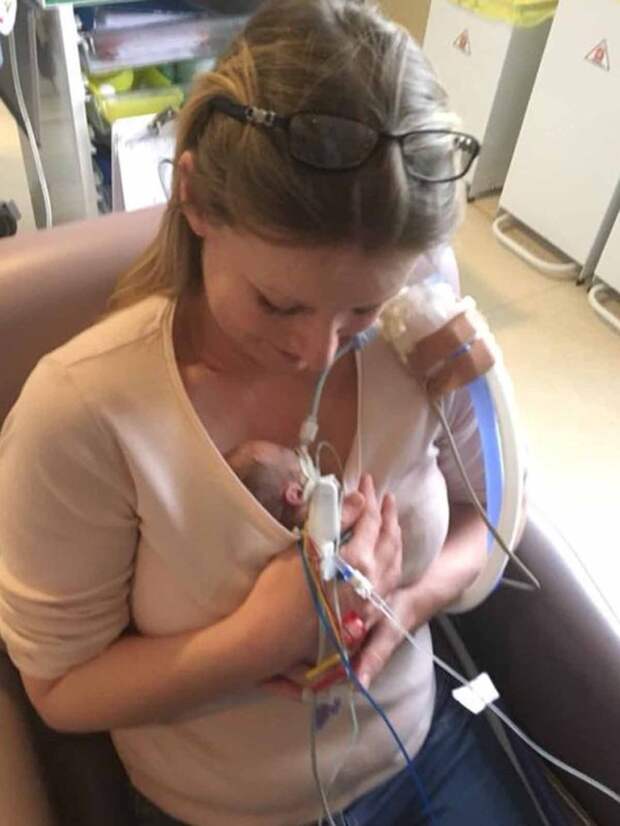 Baby survives 17 days in womb after twin is stillborn