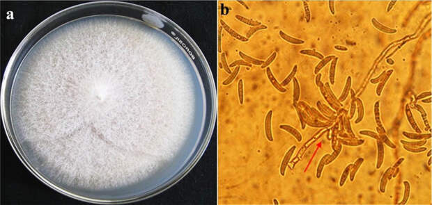 Рис. 2. Культуральные и морфологические признаки Fusarium oxysporum f. sp. lycopersici