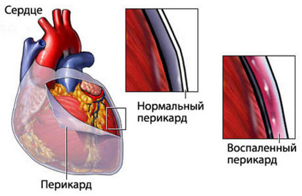 Что такое альтерация? Первичная и вторичная альтерация