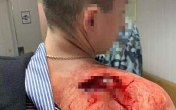 В Днепре пьяный полицейский устроил драку в баре и подстрелил охранника
