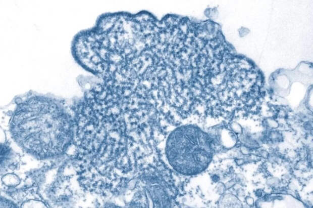 Вирусолог Нетесов оценил опасность смертельного вируса Нипах для россиян