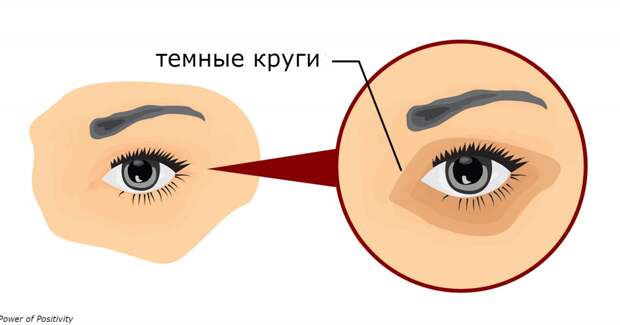 5 Ð¿ÑÐ¾Ð±Ð»ÐµÐ¼ ÑÐ¾ Ð·Ð´Ð¾ÑÐ¾Ð²ÑÐµÐ¼, Ð¾ ÐºÐ¾ÑÐ¾ÑÑÑ Ð¼Ð¾Ð³ÑÑ Ð³Ð¾Ð²Ð¾ÑÐ¸ÑÑ ÐºÑÑÐ³Ð¸ Ð¿Ð¾Ð´ Ð³Ð»Ð°Ð·Ð°Ð¼Ð¸
