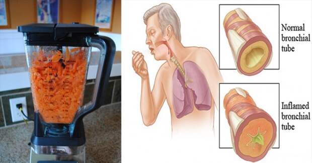 Морковь: избавит от кашля и выведет мокроту из легких