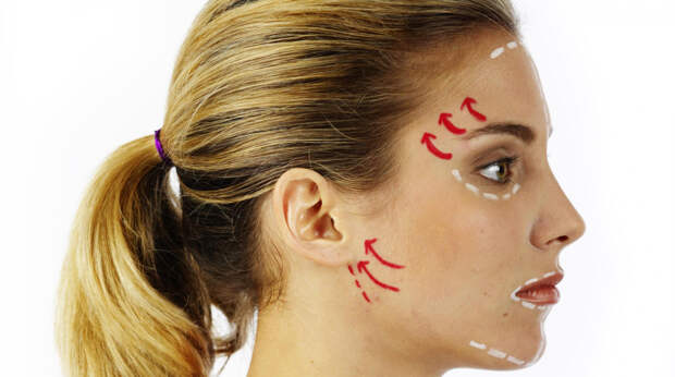 Хирург Сафонова: SMAS-лифтинг лица поможет вернуть четкий контур