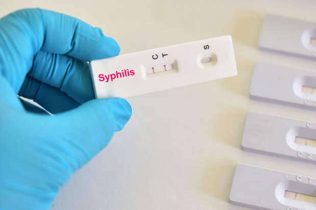 Врач Заславский: анализ на сифилис - реакция Вассермана - в России не проводится