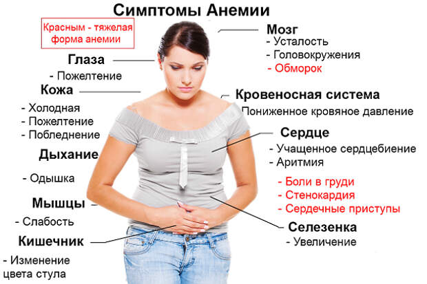Симптомы анемии