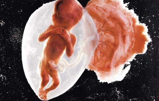 Первая фотография эмбриона ребенка.