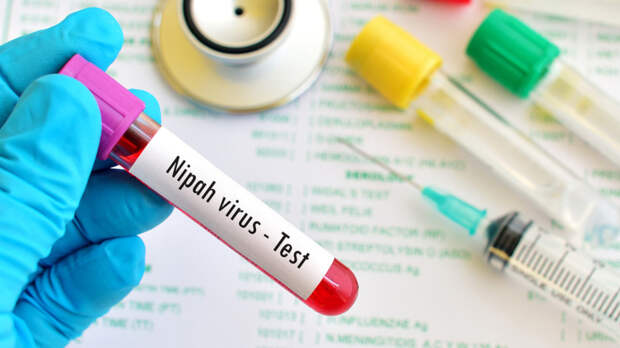 О распространении нового вируса Нипах рассказали в ВОЗ