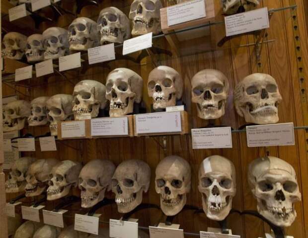 Коллекция черепов музея Мюттера в Филадельфии (США)./Фото: img.pravda.ru