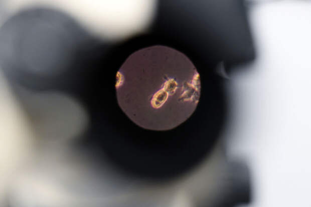 Роспотребнадзор: вирус Нипах циркулирует на территориях азиатских стран