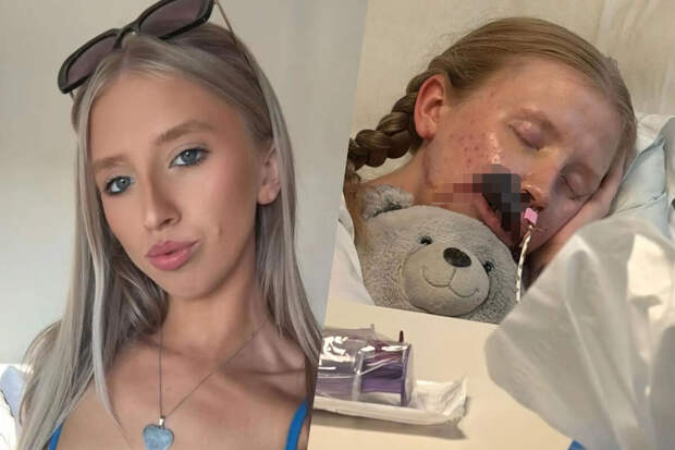 The Sun: британка лишилась части лица после нападения собаки