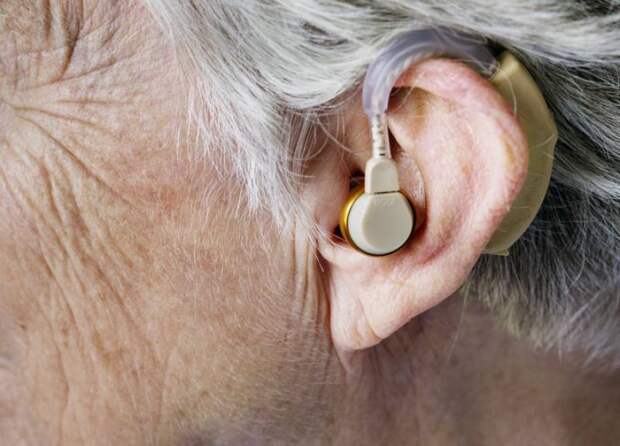Вправе ли я требовать бесплатный ремонт слухового аппарата без гарантийного талона?