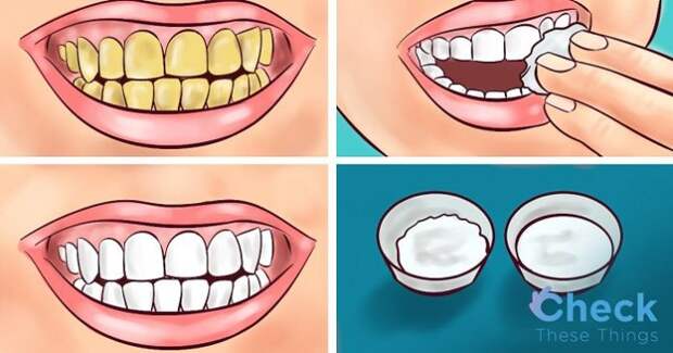 guaranteed-whiten-yellow-teeth-less-2-minutes