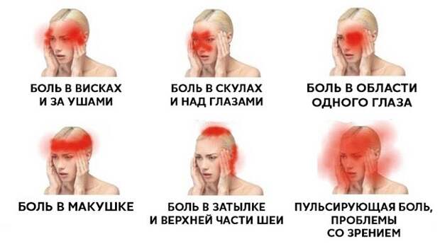Пульсирующая боль в затылке