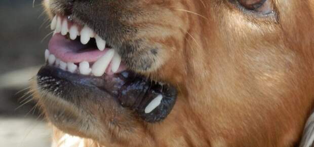 Кинолог Голубев рассказал о обработке собачьих укусов