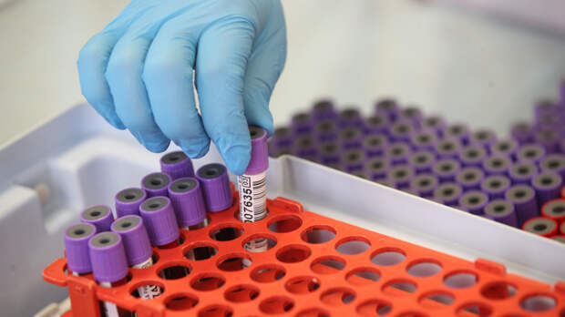 Миф о весе и холестерине: почему стройность не гарантирует здоровье сердца