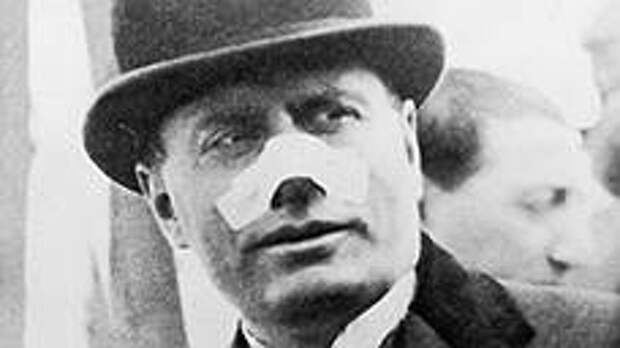 Бенито Муссолини после покушения на него, совершенного Виолеттой Гибсон 7 апреля 1926 года 