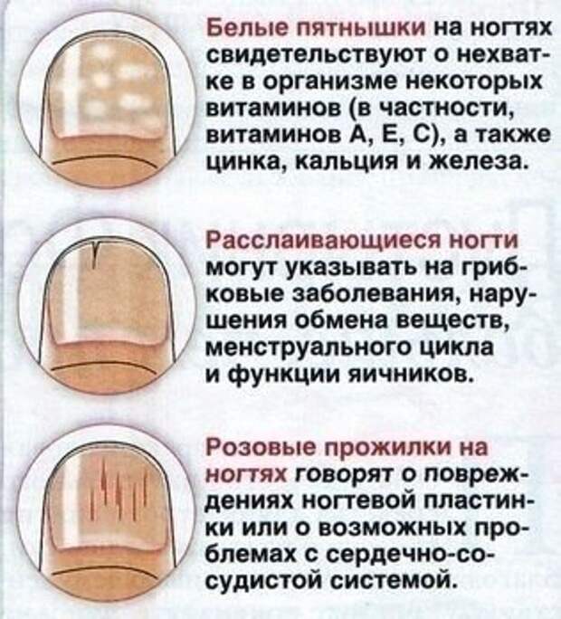 О ЧЕМ МОЖЕТ СКАЗАТЬ НОГОТЬ О ЧЕМ МОЖЕТ СКАЗАТЬ НОГОТЬ