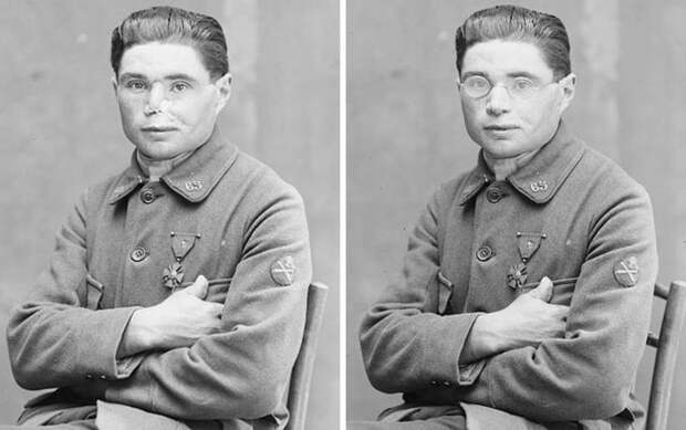 Как женщина спасала жизни ветеранов Первой мировой войны, «восстанавливая» их лица