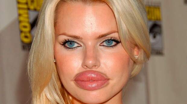 Как живут дочки и внучки силиконизированных красавиц из нулевых