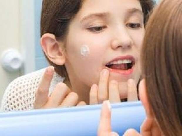 Прыщи на лице - как избавиться и причины появления. 