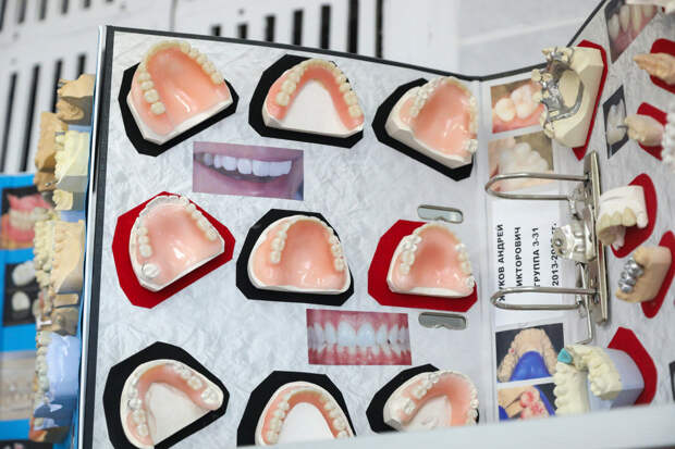 Стоматолог назвал продукты, из-за которых зубы теряют естественный цвет