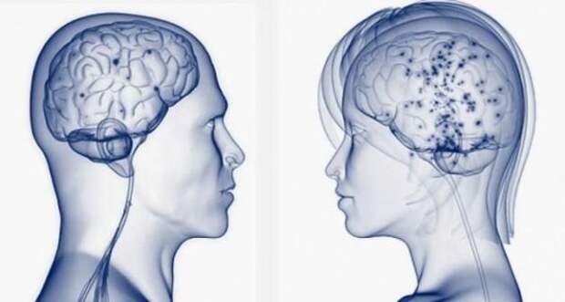 В чем же отличия между мужским и женским мозгом
