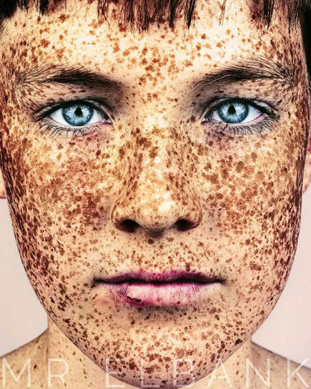 freckles-portrait-photography-brock-elbank-132__700