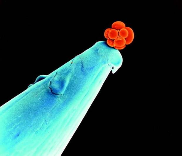 Человеческий эмбрион на кончике иголки интересное, интересные фото, неожиданно, подборка, познавательно, редкие фото, секреты, фото