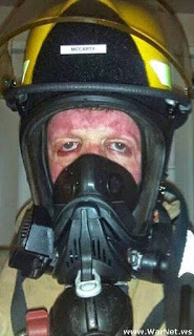 Обгоревший в детстве парень поборол страх огня, став пожарным
