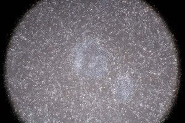 Induced pluripotent stem cells. Image credit: Shutterstock.com