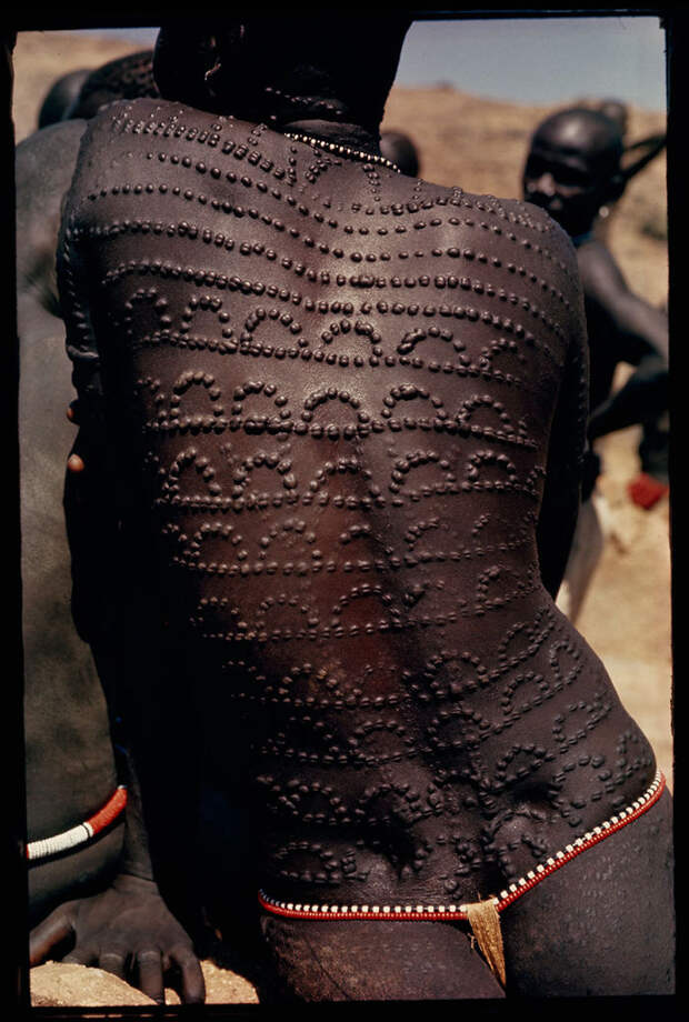 Welts, Scars Of Beauty, Pattern The Entire Back Of A Nuba Woman In Sudan, 1966