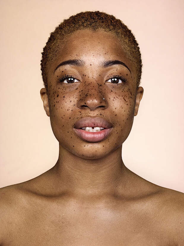 freckles-portrait-photography-brock-elbank-116__700