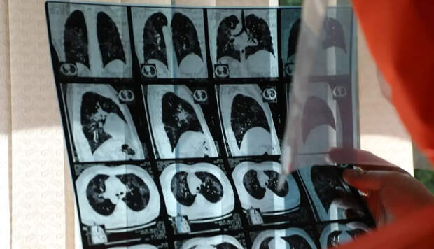 Как вернуть обоняние после коронавируса: врачи назвали самый эффективный способ