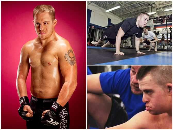 Бойцы MMA, которые добились успеха вопреки болезни