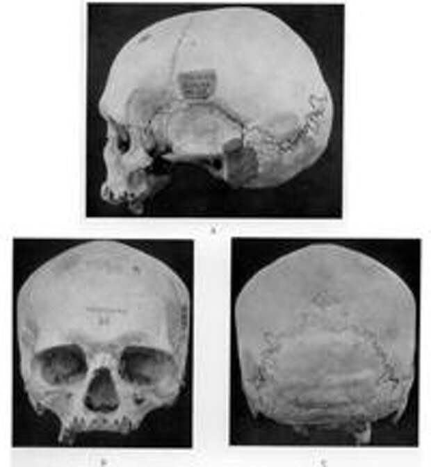 Типичный череп тасманийской женщины. 							Источник: Morant G.M. Note on Dr. J. Wunderly's survey of Tasmanian crania // Biometrika, 1939, V.30, №3/4, p.341.